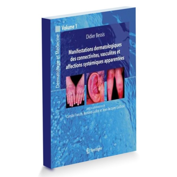 Manifestations dermatologiques des connectivites volume 1