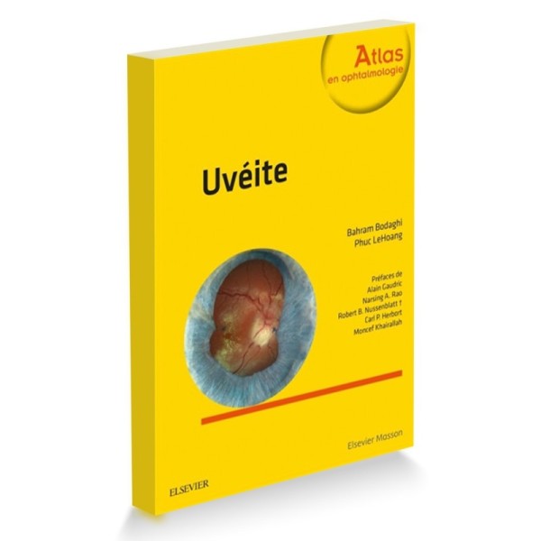 Uvéite
