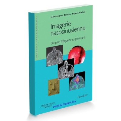Imagerie nasosinusienne