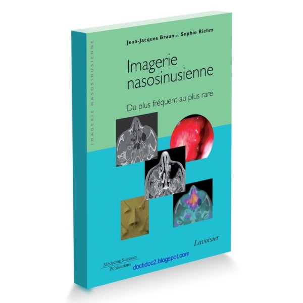 Imagerie nasosinusienne