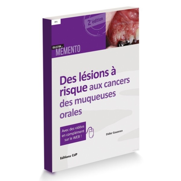 Lésions à risque aux cancers des muqueuses orales