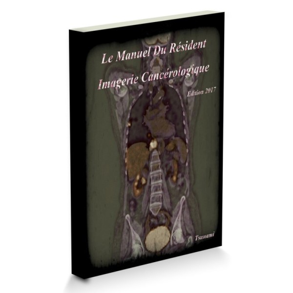 EMC Le Manuel Du Résident - Imagerie Cancérologique