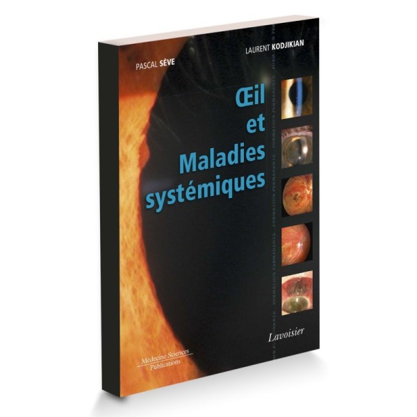 Œil et Maladies systémiques